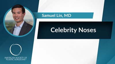 Celebrity Noses