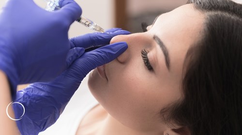 The ideal patient for nonsurgical rhinoplasty